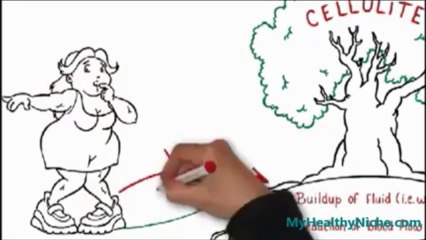 Cellulite Factor - How To Eliminate Cellulite