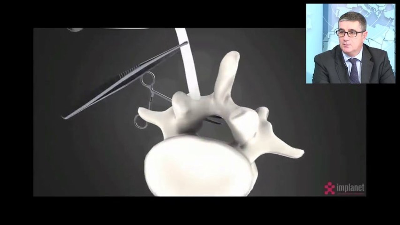 Introduction en Bourse d’Implanet