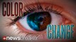 COLOR CHANGE: New Surgical Procedure to Change Eye Color