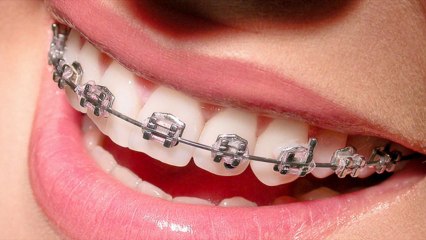 Get Second Opinion On Your Teeth or Gum Milwaukee & Shorewood, WI - Frank R. Galka, D.D.S