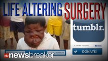LIFE CHANGING: Tumblr User Raises $10,000 to Correct Orphan?s Facial Deformity