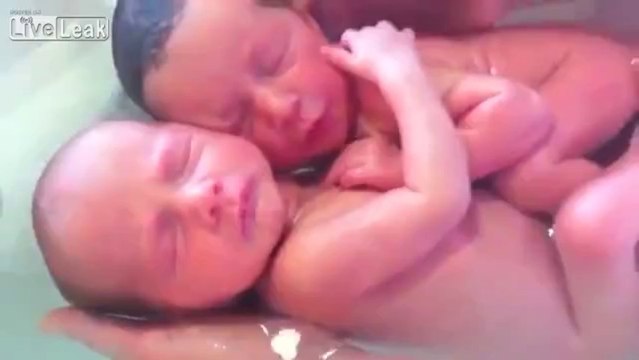 Twins were born, but haven't realized that