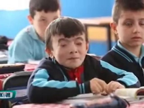 Prof. Dr. Müslime Akbaba göz kapağı tedavisi hakkında bilgi veriyor part 1