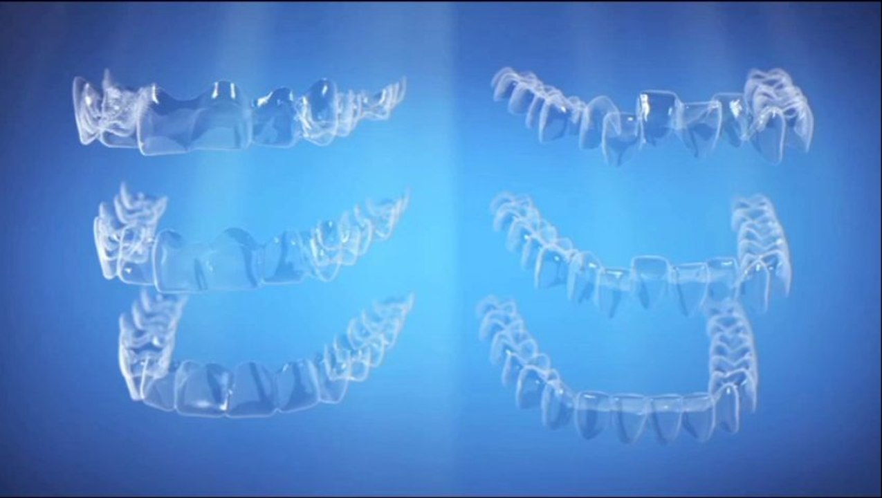 Invisalign New Jersey