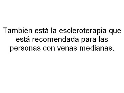TRATAMIENTOS PARA LAS VARICES