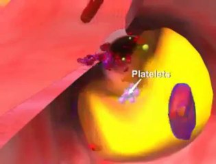 Heart Attack Awareness: How to Recognize and Prevent It ❤️