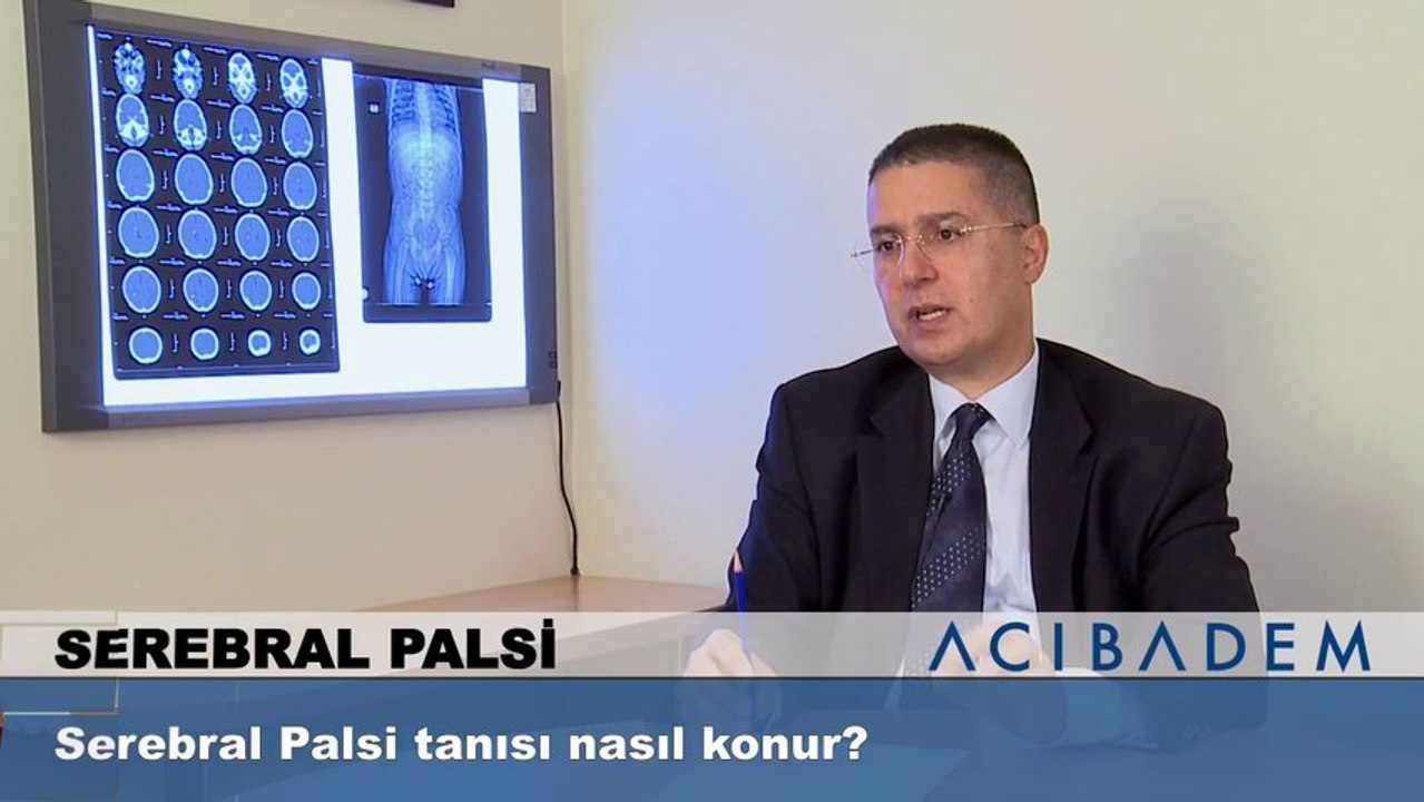 Serebral Palsi tanısı nasıl konur?
