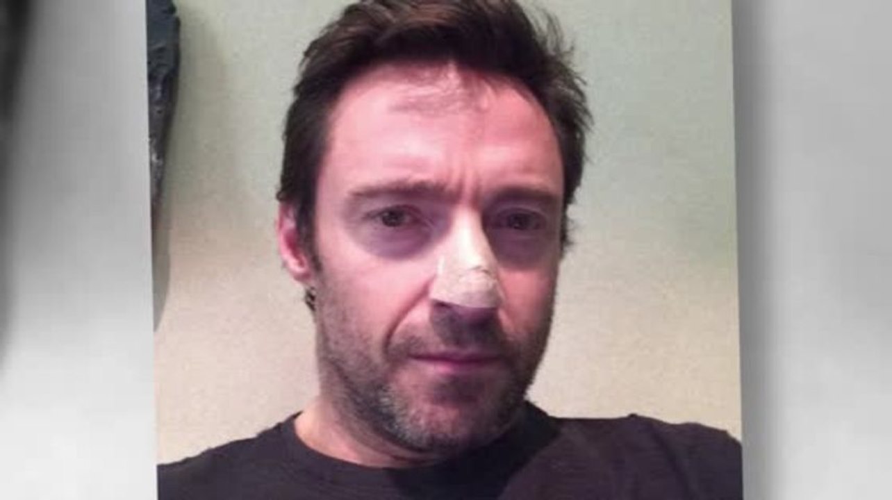 Hugh Jackman Has Skin Cancer Spot Removed