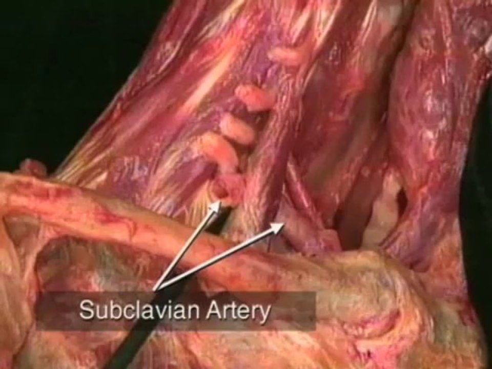 Myofascial, deep tissue, & joint stretching for Thoracic Outlet Sundrome