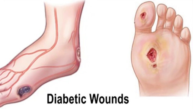 Podiatrist - Diabetic Wound Care - DeBary, DeLand and Deltona, Florida