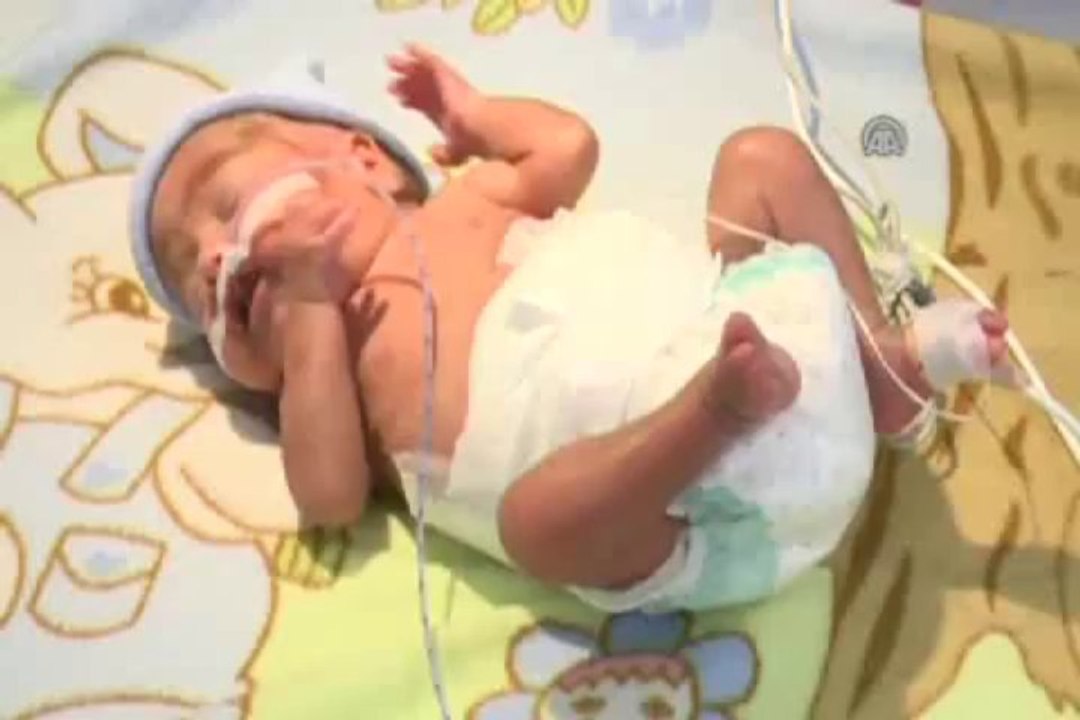 Cesur bebek taşıma sütle hayata tutundu