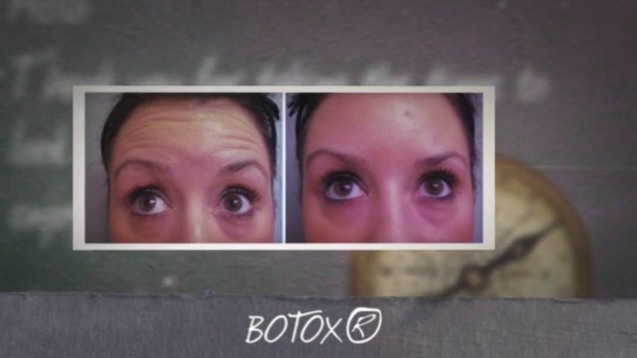 Chemical Peel Treatment Mesa AZ | Facial Resurfacing | (480) 832-7546