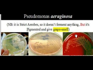 Explaining Something by Me