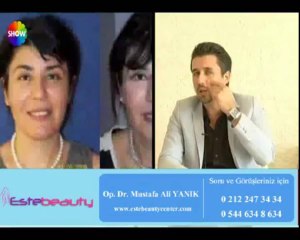 Op. Dr. Mustafa Ali Yanık  35 - 40 Dk. da İplerle yapılan gençleştirme işlemi Anlatıyor...