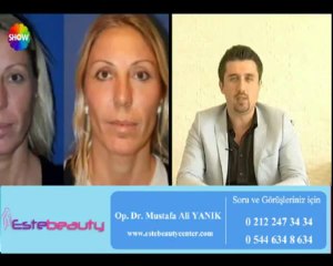 Op. Dr. Mustafa Ali Yanık Yüz Germe Estetiğini anlatıyor