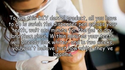 Complete Details About Idol White