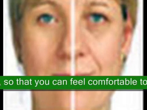 Dermal Fillers Treatment Brighton