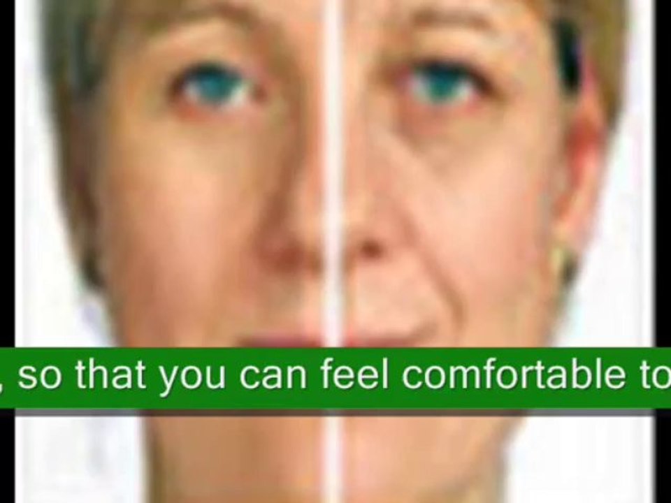 Dermal Fillers Treatment Brighton