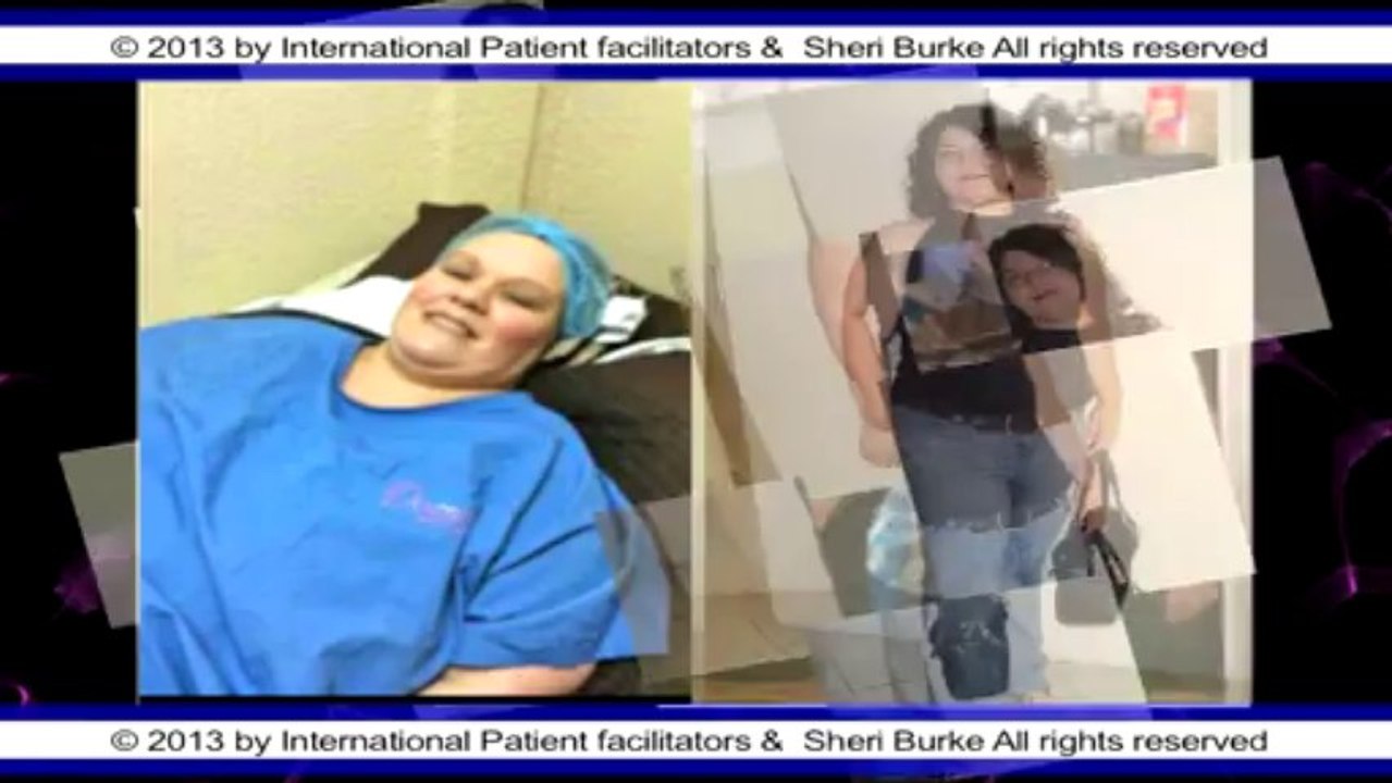 Weight Loss Surgery Mexico by Sheri Burke