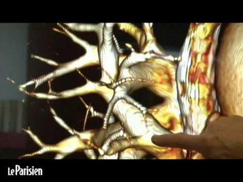 Dissections virtuelles de cadavres en 3D