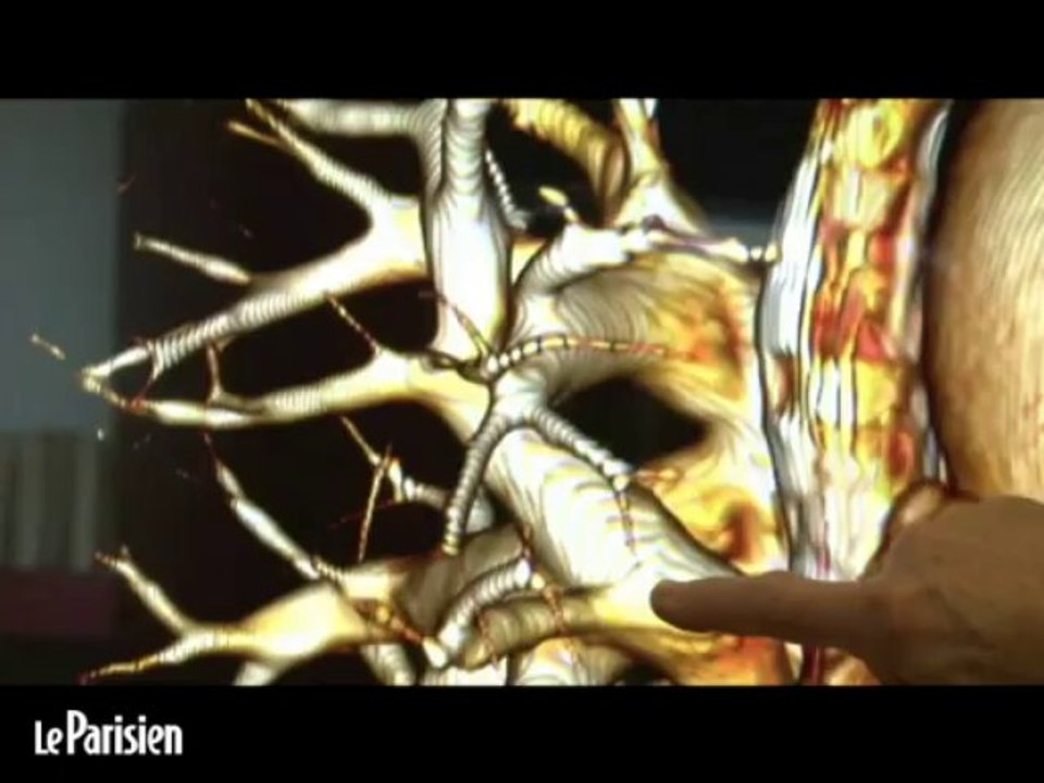 Dissections virtuelles de cadavres en 3D