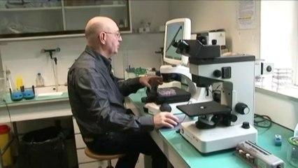 Il fabrique de la cornée avec des cheveux