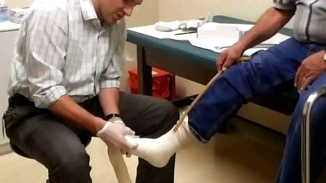 Custom Foot Orthotics- How Inserts Are Made- Impression Technique