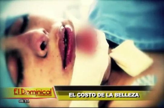 El costo de la belleza: tratamientos invasivos comprometen nuestra salud
