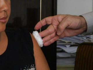 Rougeoles, oreillons: les moins de 30 ans insuffisamment protégés - 10/12