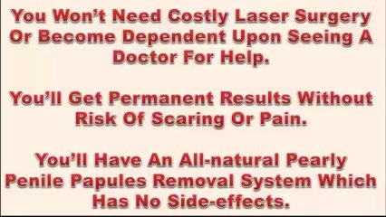 Pearly Penile Papules Treatment At Home
