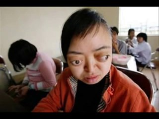 Agent Orange au Vietnam