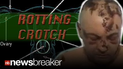 ROTTED CROTCH: Teenager in Mexico Reportedly Injecting Krokodil into her Vagina