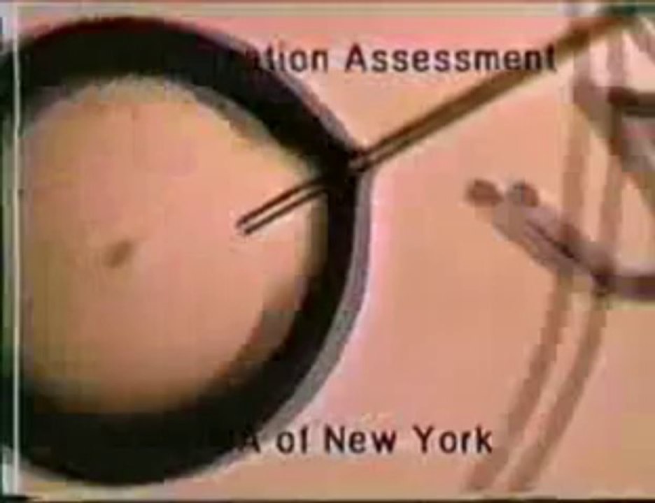 Dr.Malpani,Exclusive- Inside the IVF Lab (1)