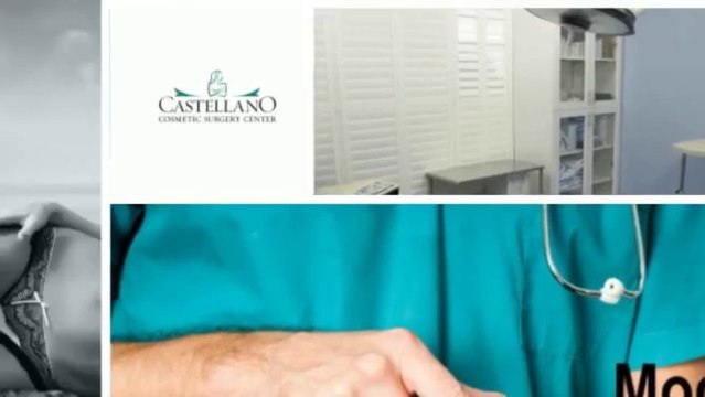 Breast Augmentation in Tampa, FL (Low)