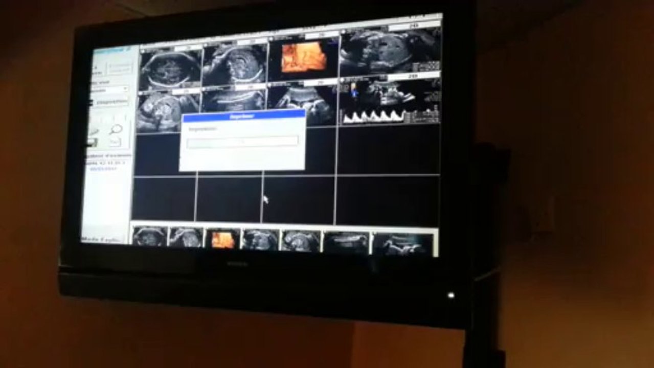 Troisième échographie Giulia