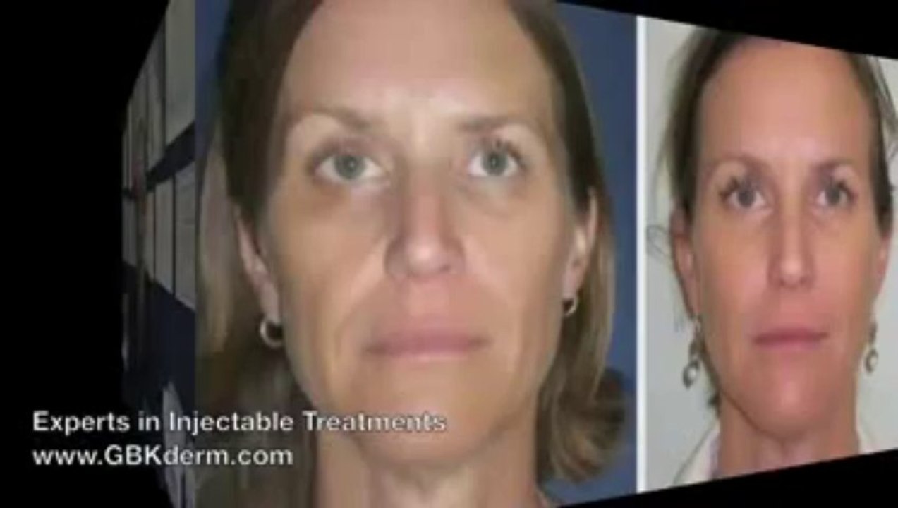 Body Contouring San Diego