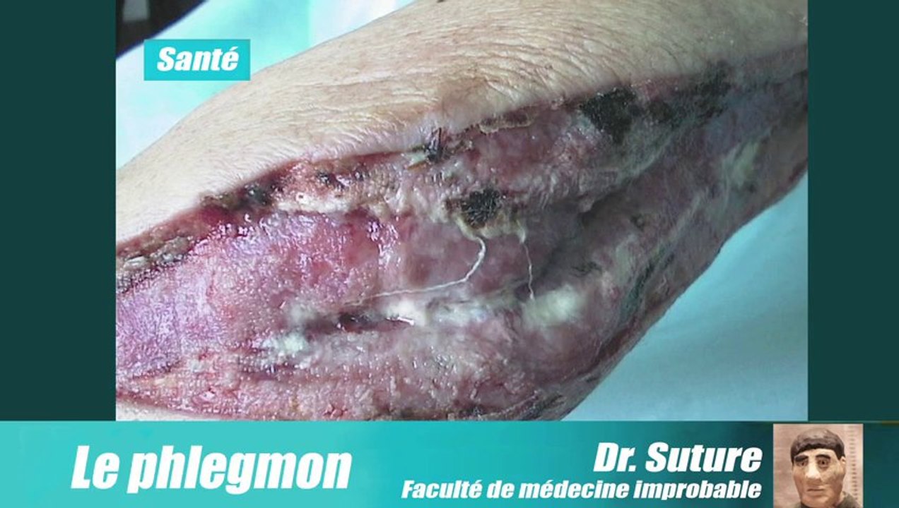 Docteur Suture, cas n°3 - "le Ricané"