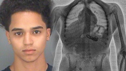 Florida Man Caught with Stolen Jewelry in His Stomach