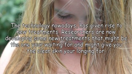 If You Are Serious About Acne Treatment.