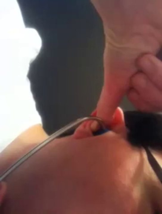 How To Mold Your ZenPlugs Molded Stethoscope Earpieces