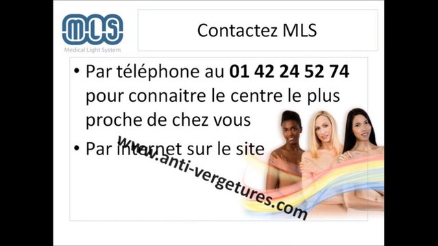 Centre MLS _ Traitement des vergetures par LED - vergetures