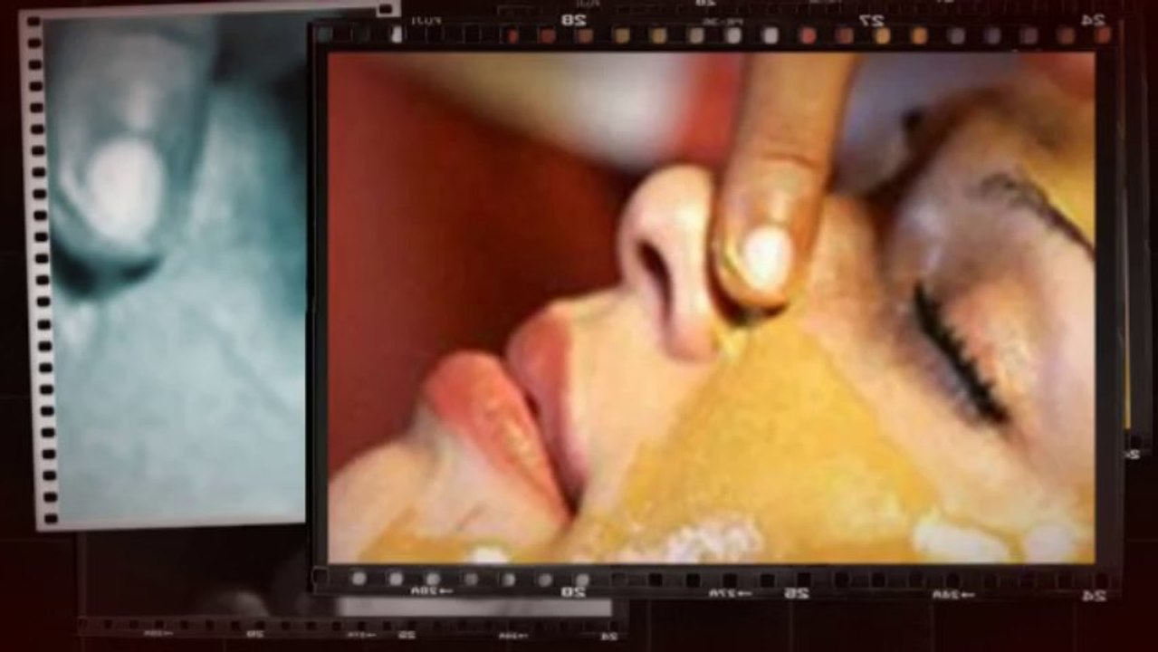 Hyperpigmentation treatment