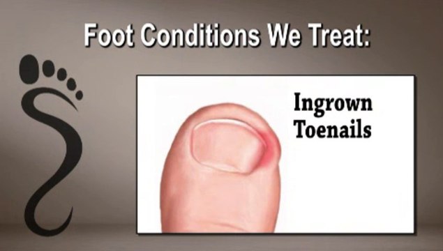 Podiatrist in Oro Valley, Tucson, Green Valley ,AZ - Richard Quint, DPM - Arizona Foot Specialists