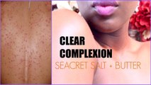 CLEAR COMPLEXION | ACNE on your back   Lighten Knuckles and Elbows   Deep Body Exfoliation