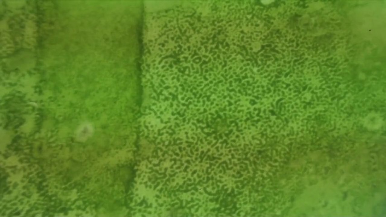 Algae-graphie au bout de la lentille