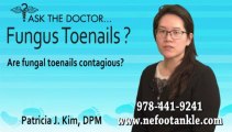 Fungal Toenails Contagious? Podiatrist in Newburyport, Chelmsford, Lawrence, MA