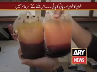 Water Mixed In Blood