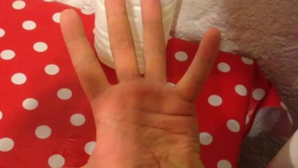 Comment enlever de la colle forte des doigts