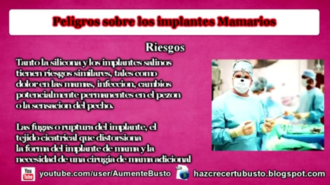 Tipos de Implantes Mamarios