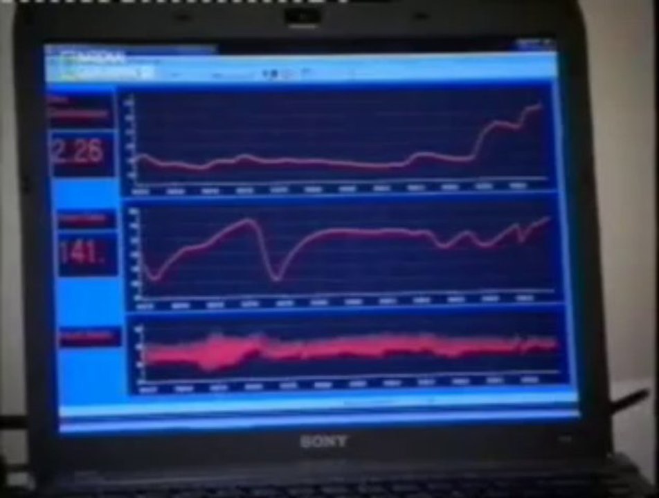 Psicologia: El estres del rechazo social
